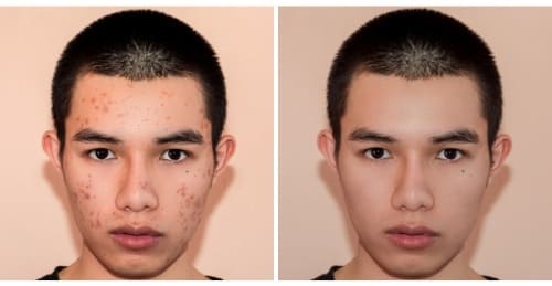 Methamphetamine-Transformation-Symptoms